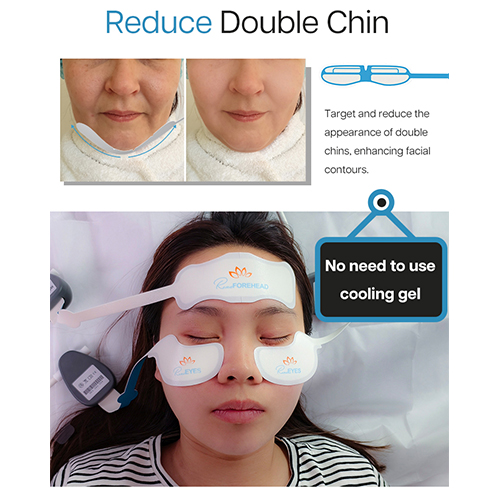 High-Intensity Electromagnetic Stimulation Synchronized RF Renaface Facial Lifting System