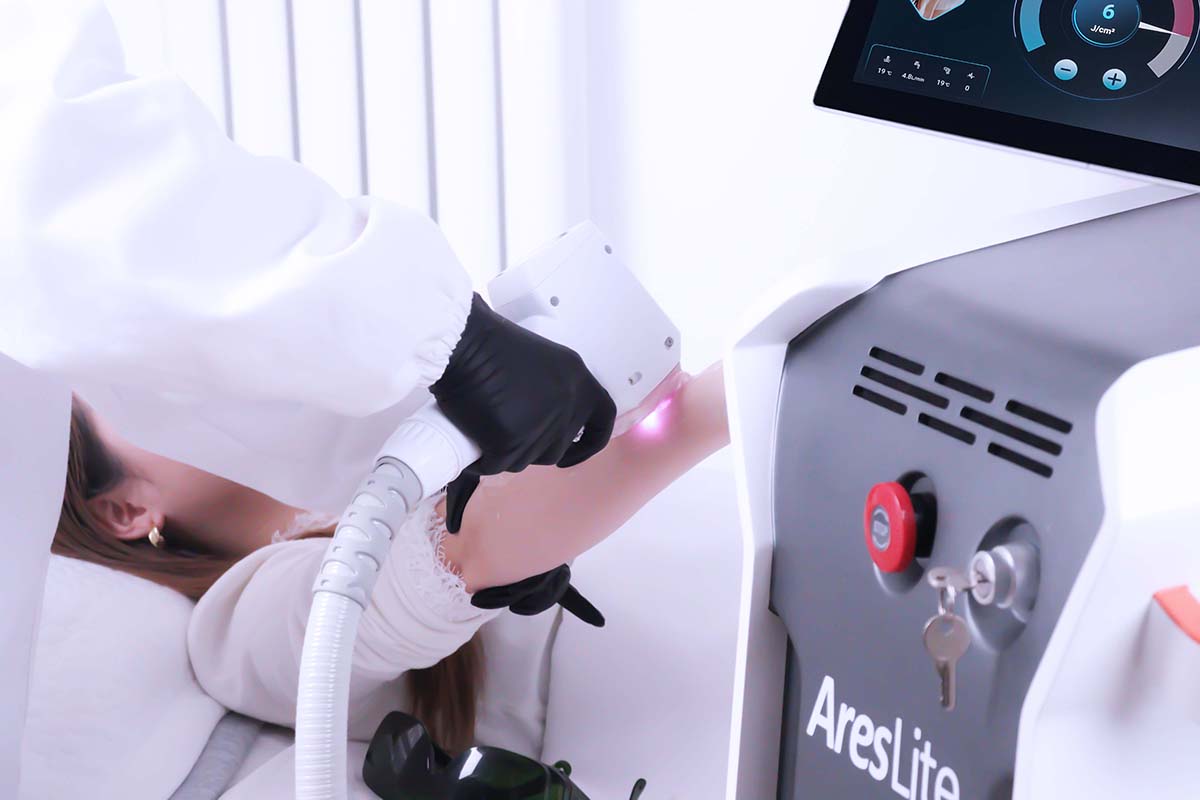 areslite dm40p laser machine